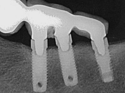 Capture s59tm2 - Eugenol