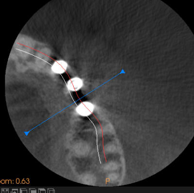 Capture wqhny6 - Eugenol