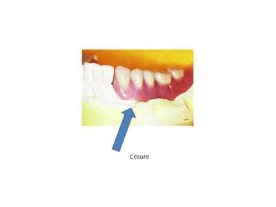 Cas 1 c igewxw - Eugenol