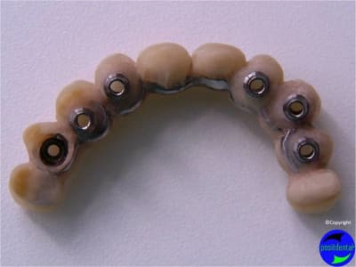 Cas clinique mci  dr j r me galaup - Eugenol