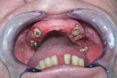 Claudec extrao2 wmiz7x - Eugenol