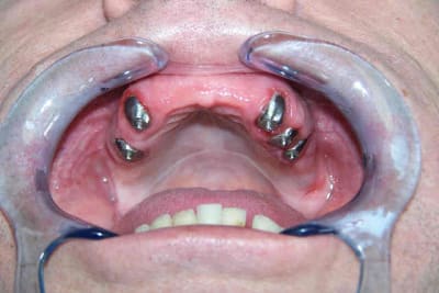 Claudec extrao4 twfjr4 - Eugenol