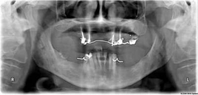 Claudec pano ccpbkn - Eugenol