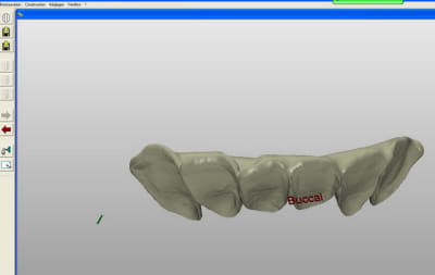 Clip resize ill9g7 - Eugenol