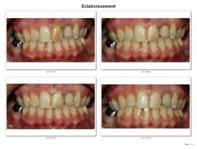 Contactsheet beta test 2 efnggb - Eugenol