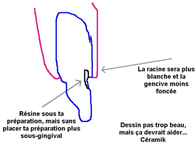 Cut back centrale nrckpj - Eugenol