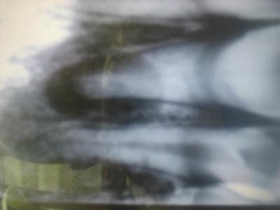 Dents 2 001 x9mfgh - Eugenol