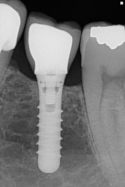 Dr zhivago iy1lrk - Eugenol