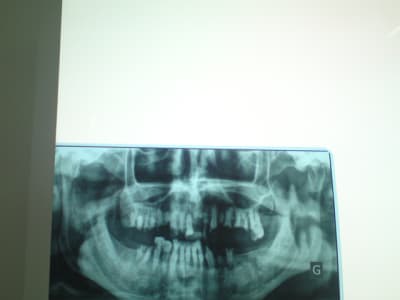 Dsc00644 2 sv3d3g - Eugenol