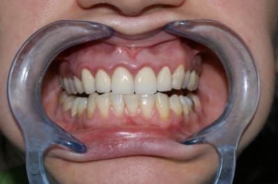 Dsc02699 z4gtnt - Eugenol