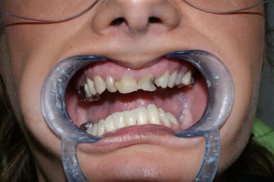 Dsc03297  1  kdymqy - Eugenol