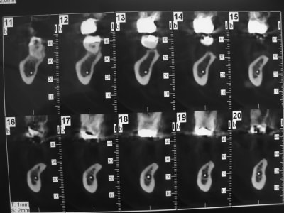 Dsc05915 xygrge - Eugenol