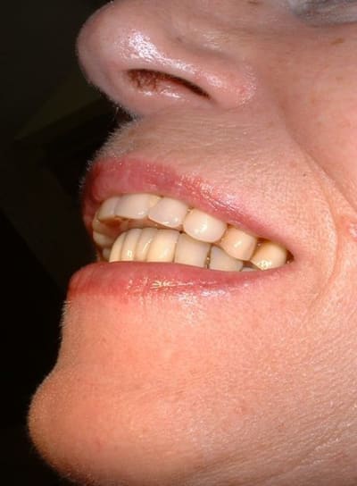 Dscf0004  800x600  cr7dup - Eugenol