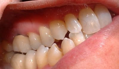 Dscf0007 qpnsul - Eugenol