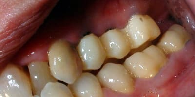 Dscf0008 kqlki7 - Eugenol