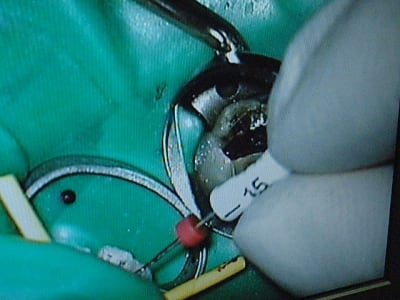 Dscf0088 oj32wm - Eugenol