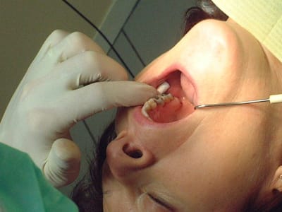 Dscf0101 mcj4ww - Eugenol