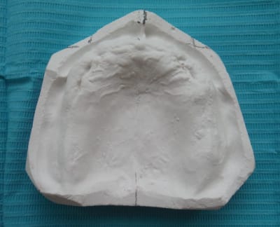 Dscf0558  2  pxo1nk - Eugenol