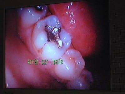 Dscf0687 pg2cxd - Eugenol