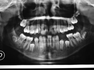 Dscf1397 xtybcy - Eugenol