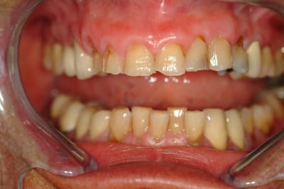 Dscf1441 tlernl - Eugenol