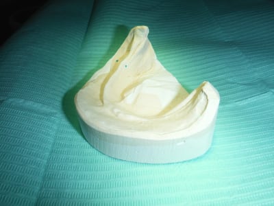 Dscf1622 jhazhd - Eugenol