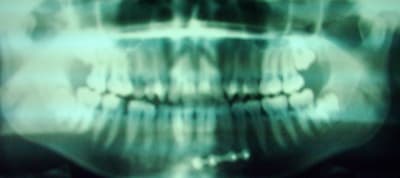 Dsci0005 c9mtga - Eugenol