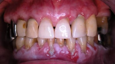 Dscn0001 gvrjz4 - Eugenol
