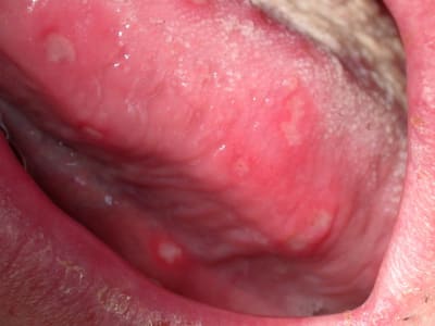 Dscn0007 p2axwf - Eugenol