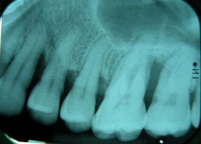 Dscn0607 mnh9mr - Eugenol