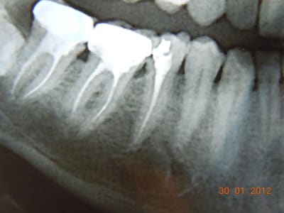 Dscn0753 ahgw2u - Eugenol