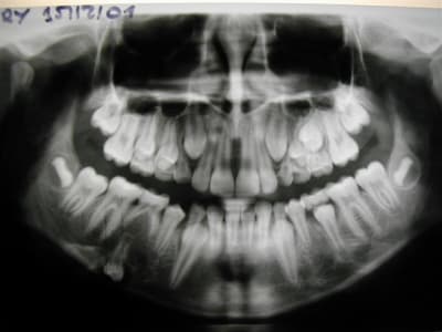 Dscn1483  small   2  vgqznq - Eugenol