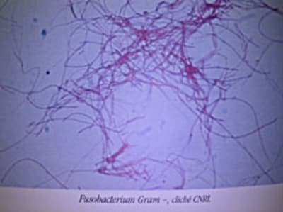 Dscn1633 zu6pwj - Eugenol
