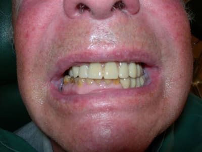 Dscn1863 f89k2v - Eugenol