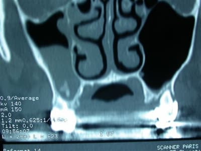 Dscn2063 scavew - Eugenol