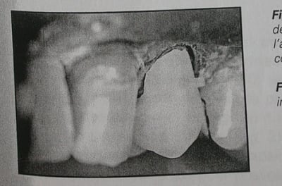 Dscn4667 edgioo - Eugenol