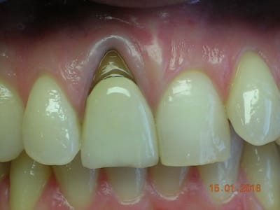 Dscn5230 rkrejm - Eugenol