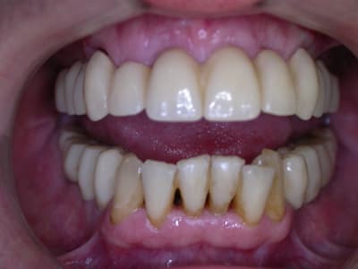 Dscn6837 rky0y7 - Eugenol