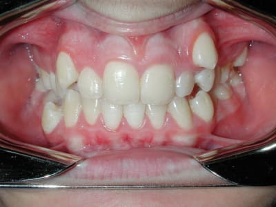 Dscn7792 qkoka2 - Eugenol