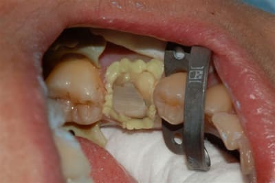 Dsc 0001 idzyz4 - Eugenol