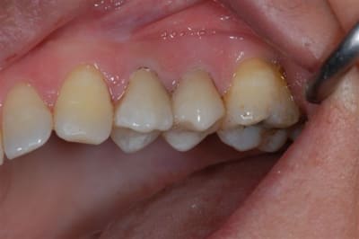 Dsc 0002 x8hc8e - Eugenol