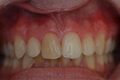 Dsc 0002 xugvzn - Eugenol