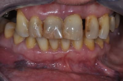 Dsc 0002 yr2vw4 - Eugenol
