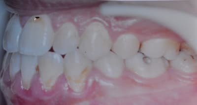 Dsc 0003 bghk3u - Eugenol