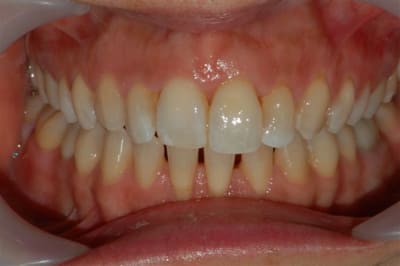 Dsc 0005 jfv6zx - Eugenol