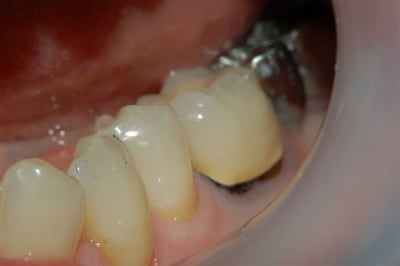 Dsc 0008 tppph1 - Eugenol