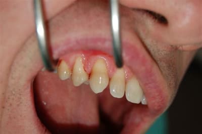 Dsc 0012 feqbs5 - Eugenol