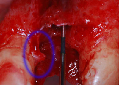 Dsc 0013 kxppon - Eugenol