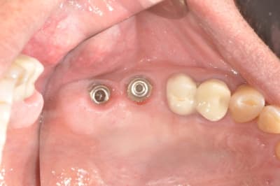 Dsc 0018 aigtdi - Eugenol