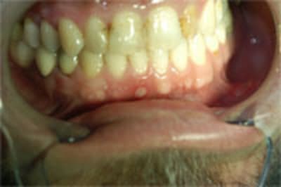 Dsc 0019 ucuhtu - Eugenol